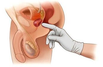 Masage prostata