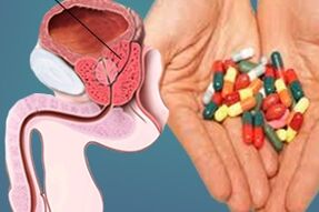 lijekovi za liječenje prostatitisa